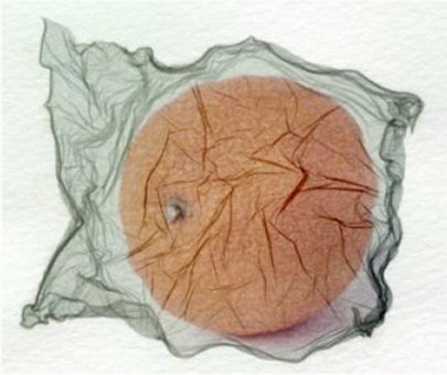 Apfelsine